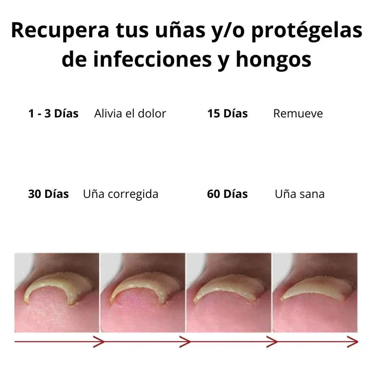 🦠ANTIHONGOS🚫